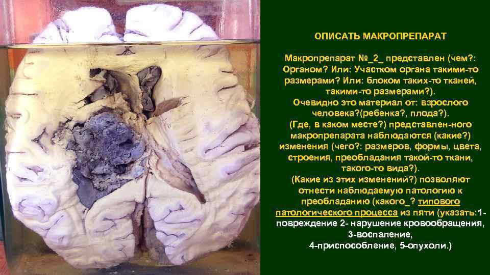 ОПИСАТЬ МАКРОПРЕПАРАТ Макропрепарат №_2_ представлен (чем? : Органом? Или: Участком органа такими-то размерами? Или: