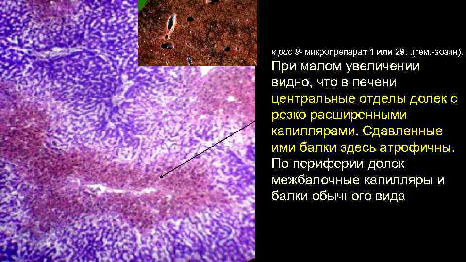 к рис 9 - микропрепарат 1 или 29. . (гем. -эозин). При малом увеличении
