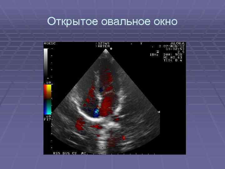 Открытое овальное окно 