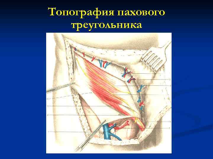 Топография пахового треугольника 