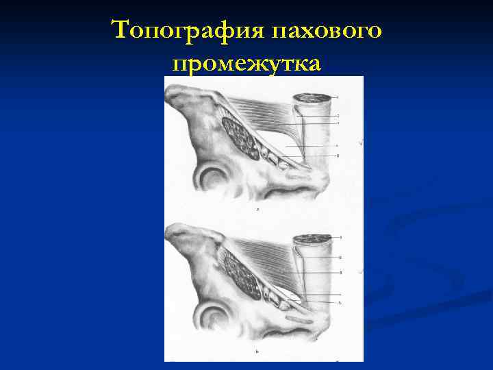 Топография пахового промежутка 