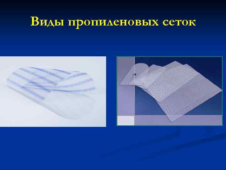 Виды пропиленовых сеток 