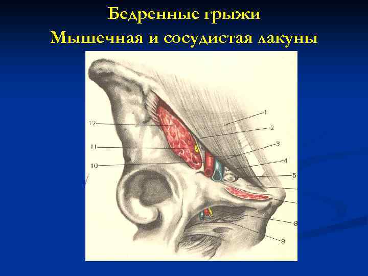 Бедренные грыжи Мышечная и сосудистая лакуны 