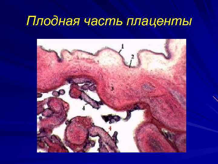 Плодная часть плаценты 
