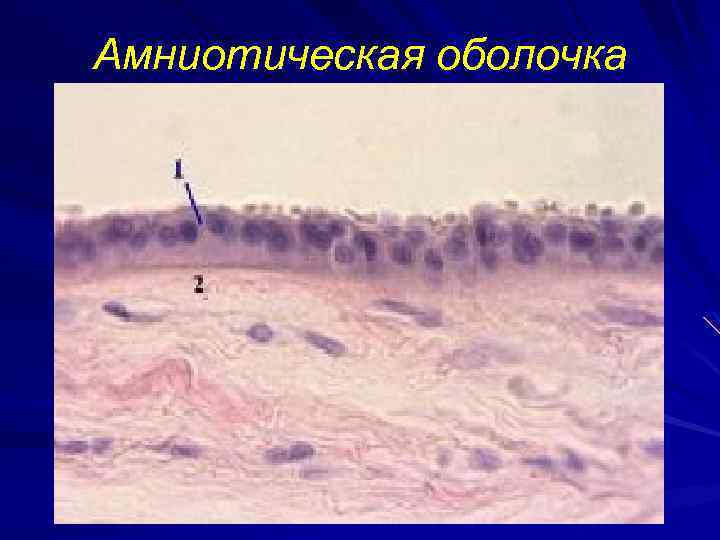 Амниотическая оболочка 