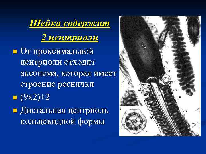 Шейка содержит 2 центриоли От проксимальной центриоли отходит аксонема, которая имеет строение реснички n