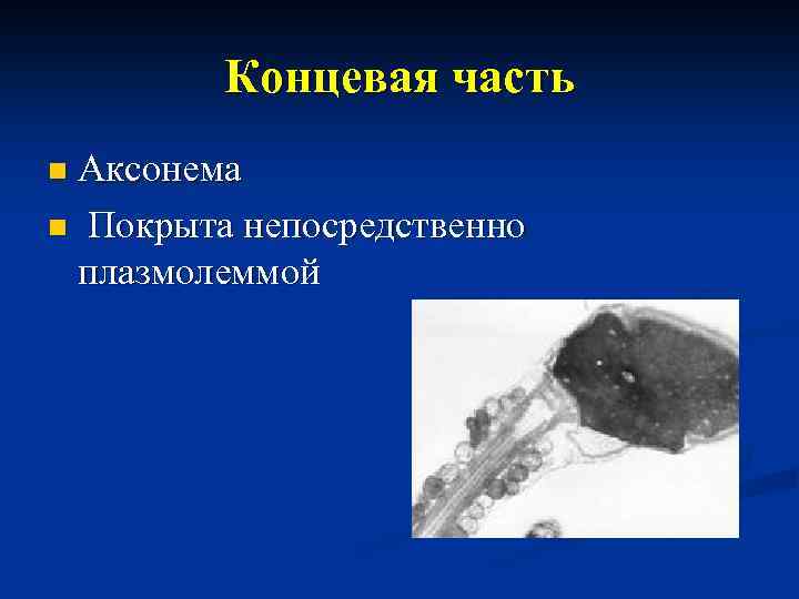 Концевая часть n Аксонема n Покрыта непосредственно плазмолеммой 