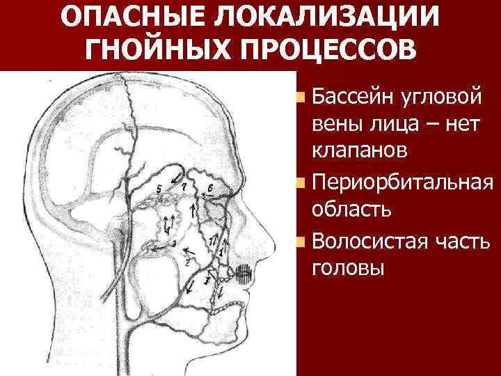 ОПАСНЫЕ ЛОКАЛИЗАЦИИ ГНОЙНЫХ ПРОЦЕССОВ n Бассейн угловой вены лица – нет клапанов n Периорбитальная