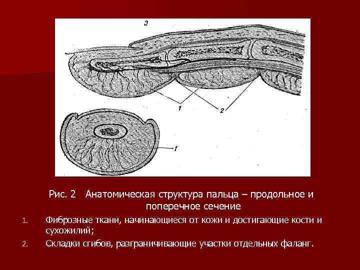 Рис. 2 Анатомическая структура пальца – продольное и поперечное сечение 1. 2. Фиброзные ткани,