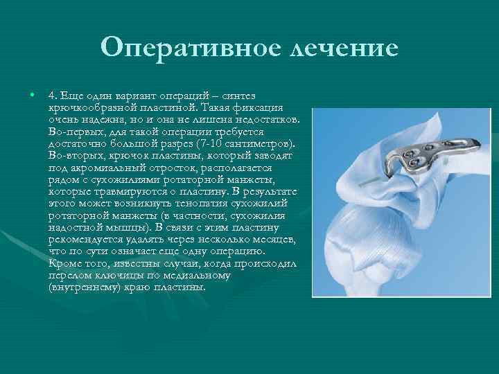 Оперативное лечение • 4. Еще один вариант операций – синтез крючкообразной пластиной. Такая фиксация