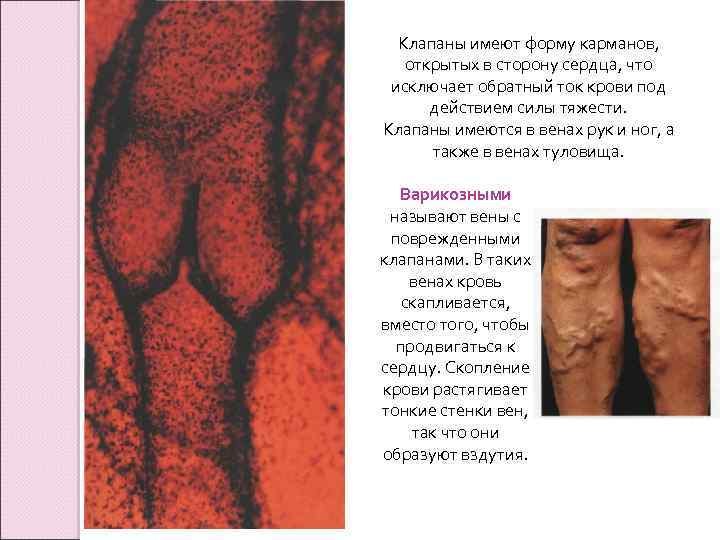 Клапаны имеют форму карманов, открытых в сторону сердца, что исключает обратный ток крови под