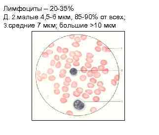 Лимфоциты – 20 -35% Д. 2. малые 4, 5 -6 мкм, 85 -90% от