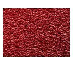 Кровь (sanguis, haima) – это ткань внутренней среды, мезенхимного происхождения, состоит из клеток и