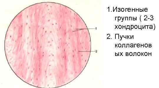 1. Изогенные группы ( 2 -3 хондроцита) 2. Пучки коллагенов ых волокон 