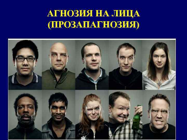 АГНОЗИЯ НА ЛИЦА (ПРОЗАПАГНОЗИЯ) 