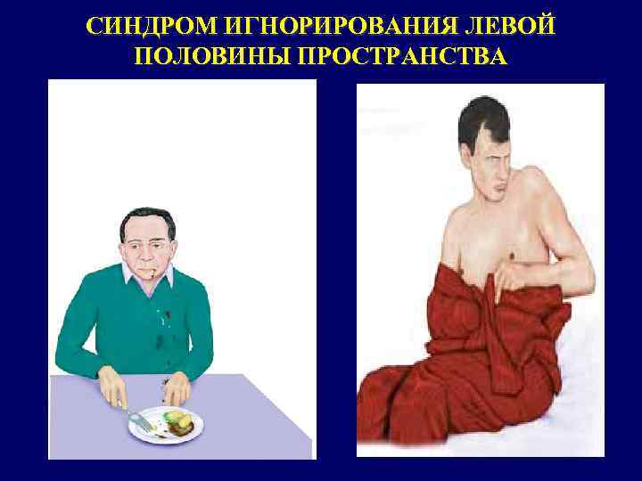 СИНДРОМ ИГНОРИРОВАНИЯ ЛЕВОЙ ПОЛОВИНЫ ПРОСТРАНСТВА 