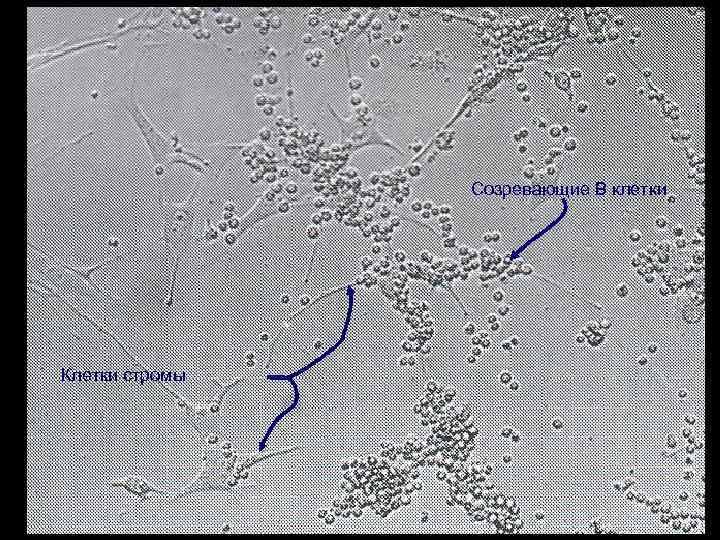 Созревающие В клетки Клетки стромы 