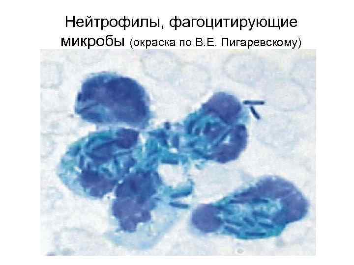 Нейтрофилы, фагоцитирующие микробы (окраска по В. Е. Пигаревскому) 