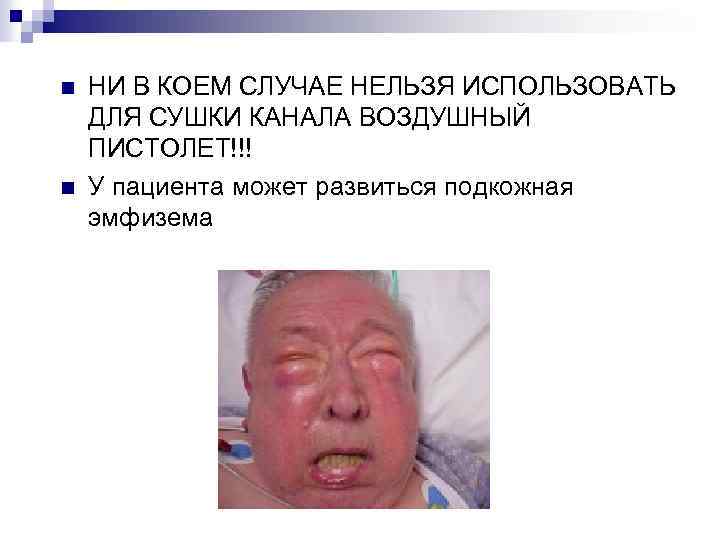 n n НИ В КОЕМ СЛУЧАЕ НЕЛЬЗЯ ИСПОЛЬЗОВАТЬ ДЛЯ СУШКИ КАНАЛА ВОЗДУШНЫЙ ПИСТОЛЕТ!!! У