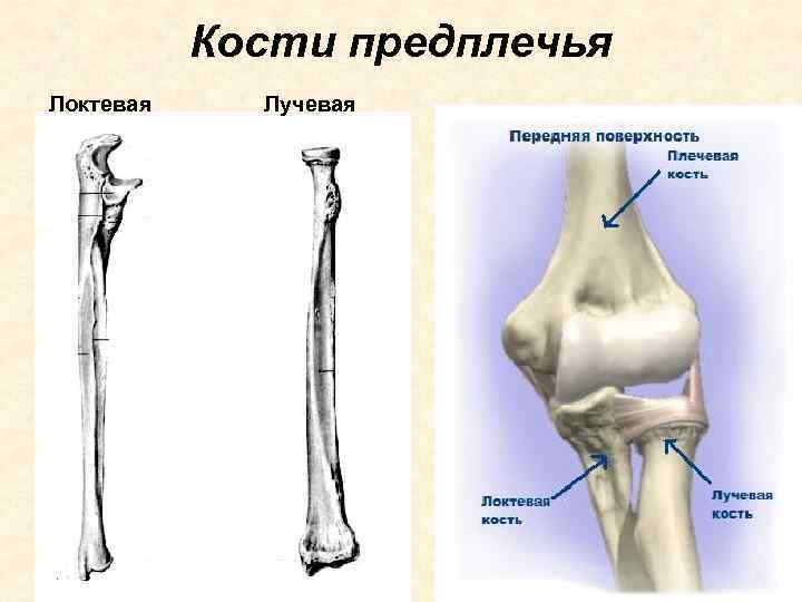 Кости предплечья Локтевая Лучевая 