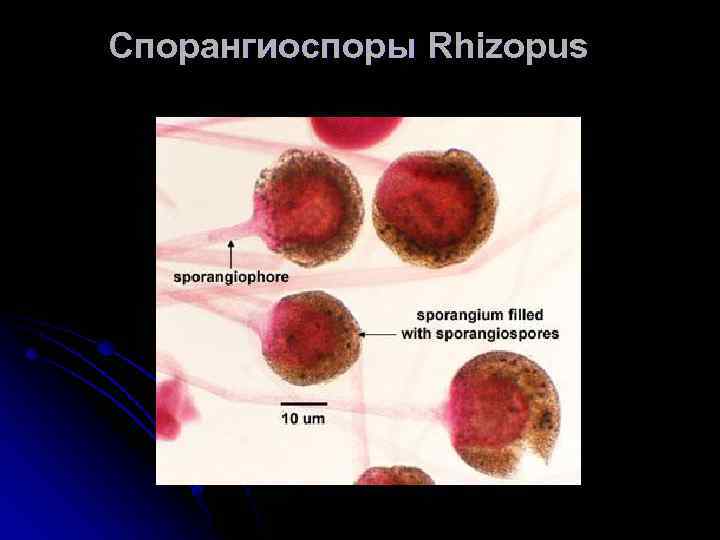 Спорангиоспоры Rhizopus 