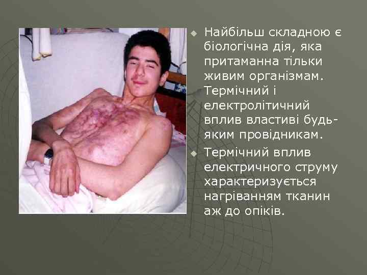 u u Найбільш складною є біологічна дія, яка притаманна тільки живим організмам. Термічний і