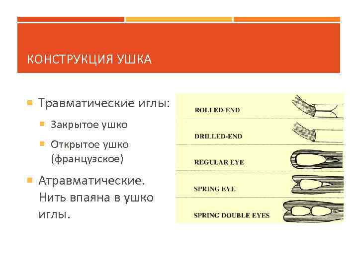 КОНСТРУКЦИЯ УШКА Травматические иглы: Закрытое ушко Открытое ушко (французское) Атравматические. Нить впаяна в ушко