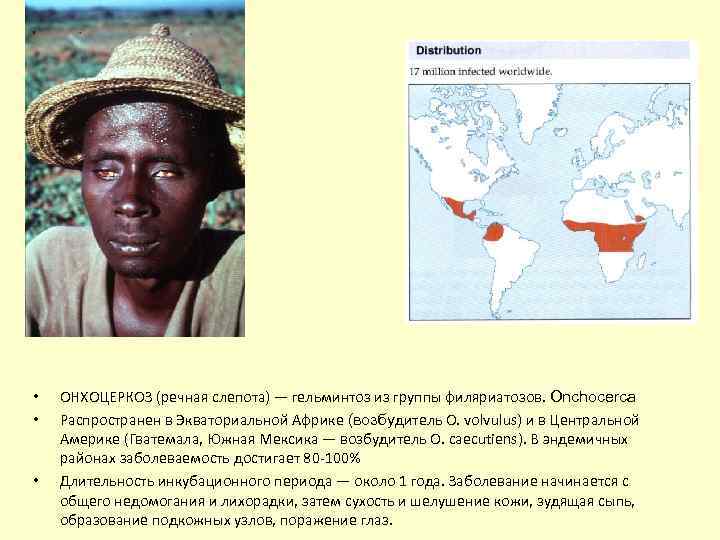  • • • ОНХОЦЕРКОЗ (речная слепота) — гельминтоз из группы филяриатозов. Onchocerca Распространен