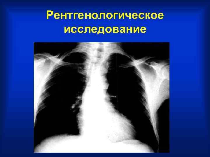 Рентгенологическое исследование 