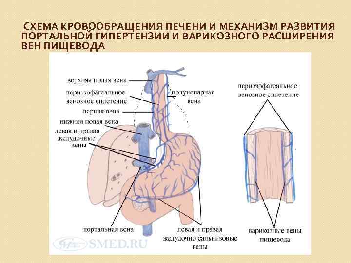 СХЕМА КРОВООБРАЩЕНИЯ ПЕЧЕНИ И МЕХАНИЗМ РАЗВИТИЯ ПОРТАЛЬНОЙ ГИПЕРТЕНЗИИ И ВАРИКОЗНОГО РАСШИРЕНИЯ ВЕН ПИЩЕВОДА 
