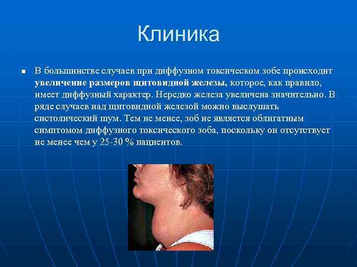 Клиника n В большинстве случаев при диффузном токсическом зобе происходит увеличение размеров щитовидной железы,