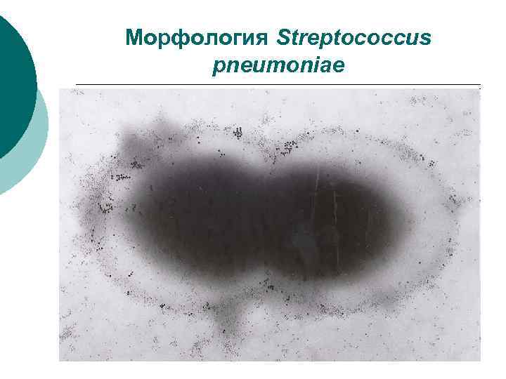 Морфология Streptococcus pneumoniae 