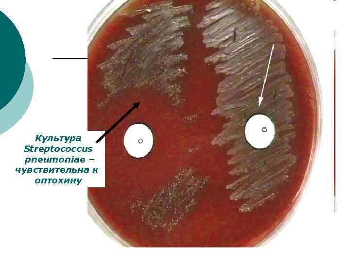 Культура Streptococcus pneumoniae – чувствительна к оптохину 