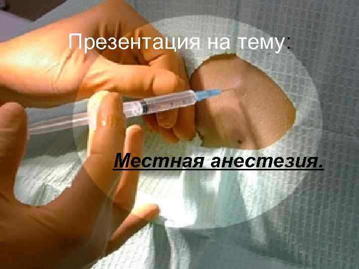 Презентация на тему: Местная анестезия. 