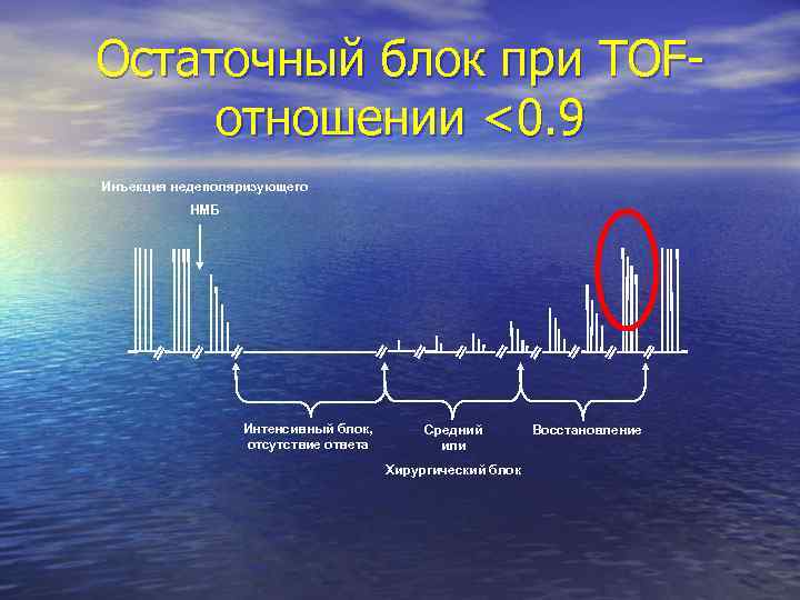 Остаточный блок при TOFотношении <0. 9 Инъекция недеполяризующего НМБ Интенсивный блок, отсутствие ответа Средний