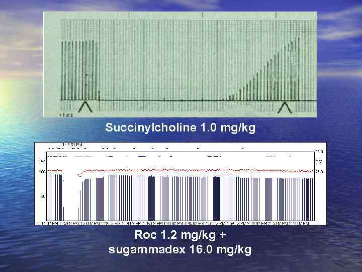 Succinylcholine 1. 0 mg/kg Roc 1. 2 mg/kg + sugammadex 16. 0 mg/kg 