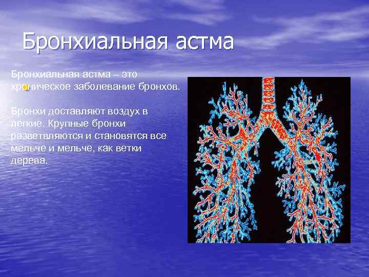 Бронхиальная астма – это хроническое заболевание бронхов. • Бронхи доставляют воздух в легкие. Крупные