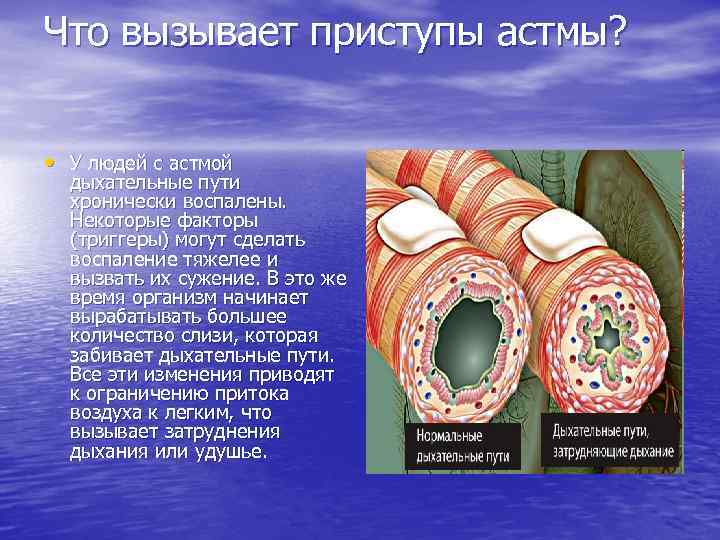 Что вызывает приступы астмы? • У людей с астмой дыхательные пути хронически воспалены. Некоторые
