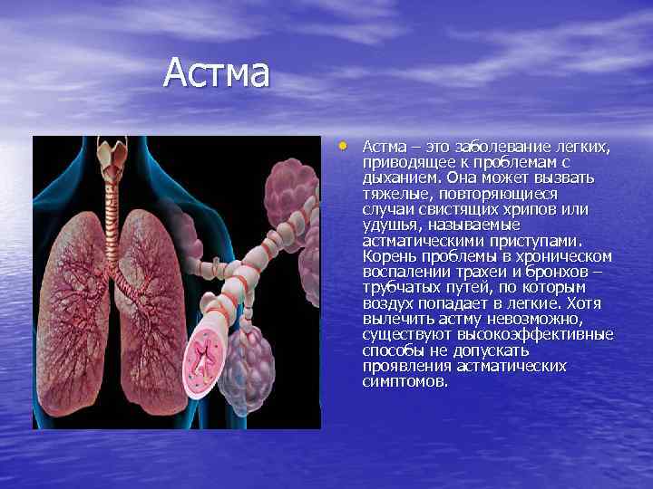 Астма • Астма – это заболевание легких, приводящее к проблемам с дыханием. Она может