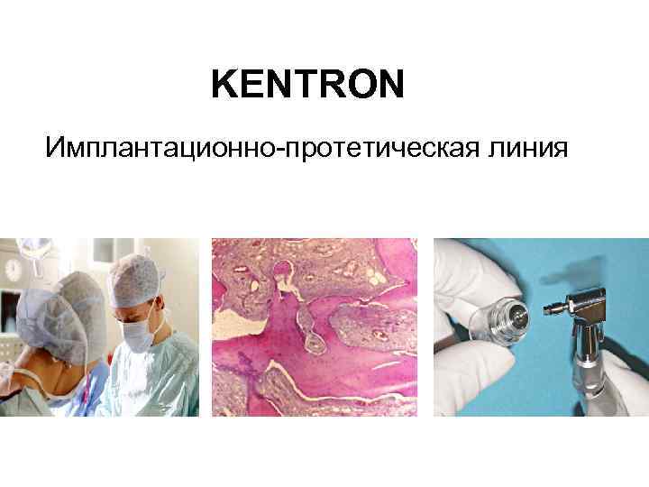 KENTRON Имплантационно-протетическая линия 