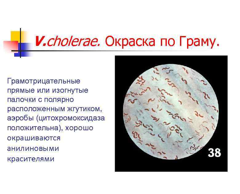 V. cholerae. Окраска по Граму. Грамотрицательные прямые или изогнутые палочки с полярно расположенным жгутиком,