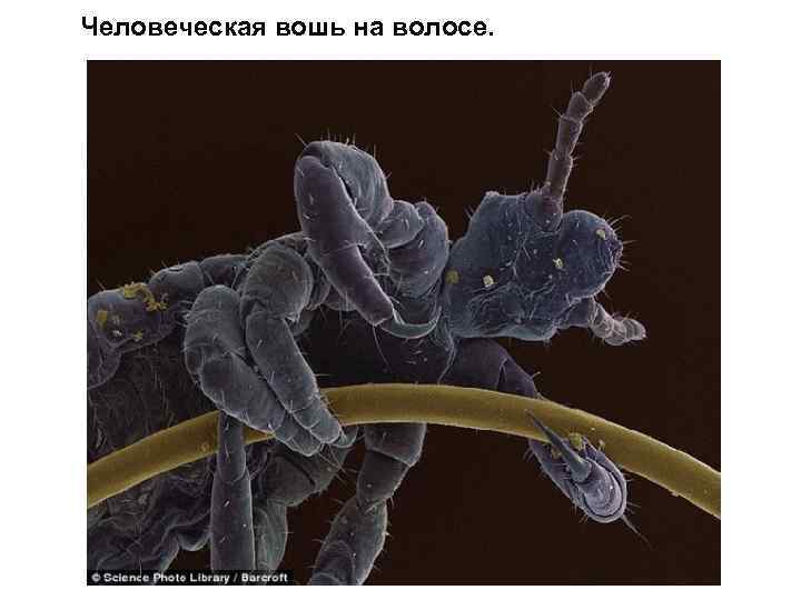 Человеческая вошь на волосе. 