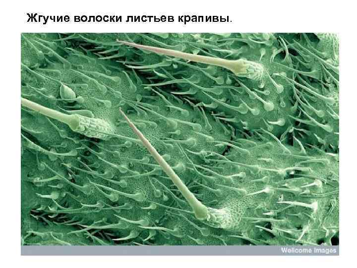 Жгучие волоски листьев крапивы. 