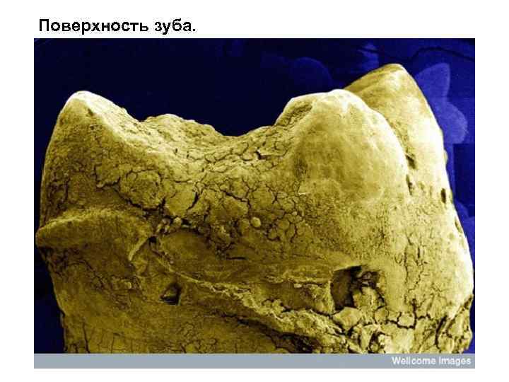 Поверхность зуба. 
