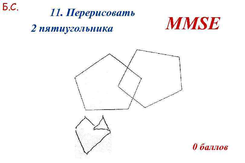 Б. С. 11. Перерисовать 2 пятиугольника MMSE 0 баллов 
