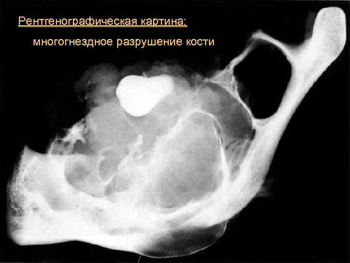 Предопухолевые процессы презентация