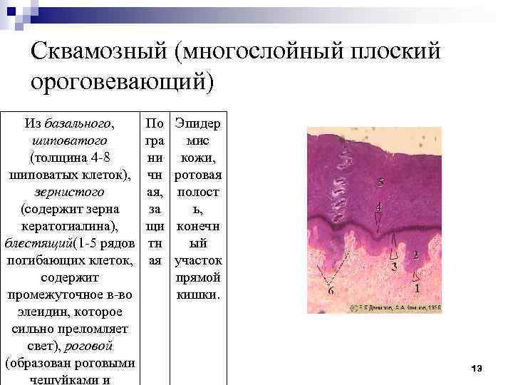 Сквамозный (многослойный плоский ороговевающий) Из базального, шиповатого (толщина 4 -8 шиповатых клеток), зернистого (содержит