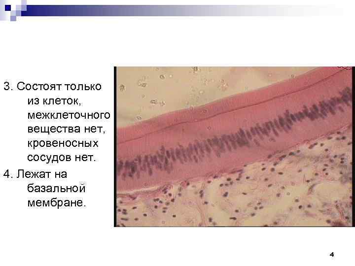 3. Состоят только из клеток, межклеточного вещества нет, кровеносных сосудов нет. 4. Лежат на