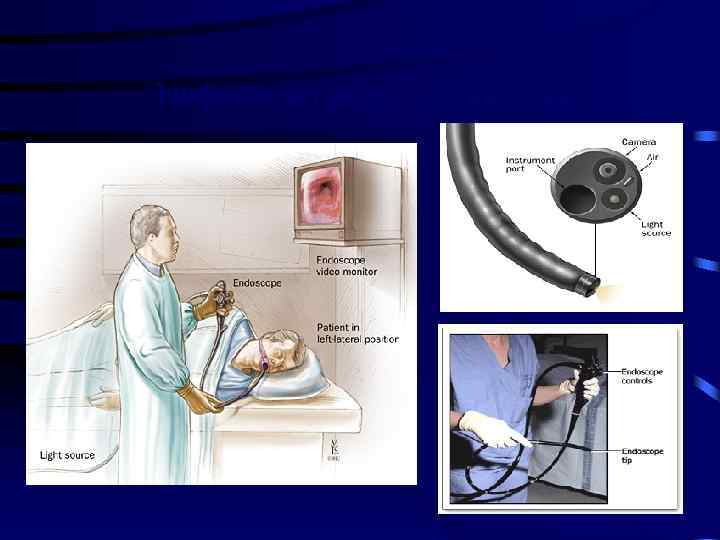 Эзофагогастродуоденоскопия 36 