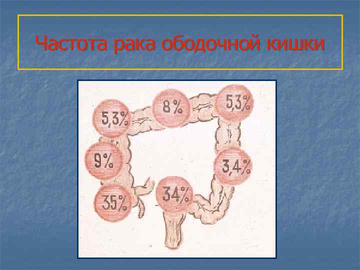 Частота рака ободочной кишки 